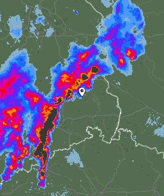 Radar