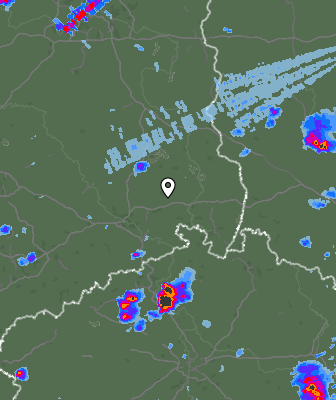 Radar