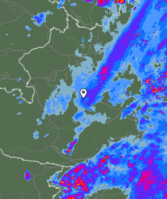 Radar