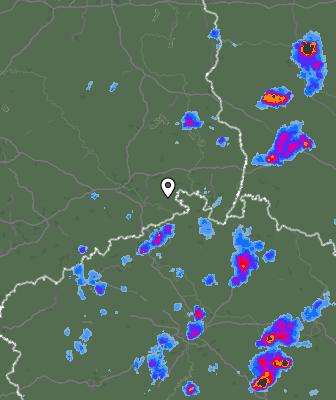 Radar