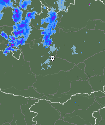 Radar