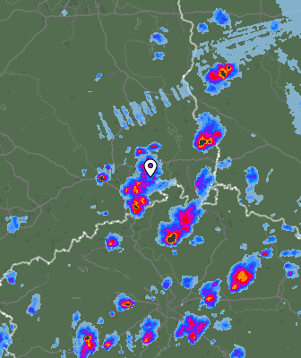 Radar