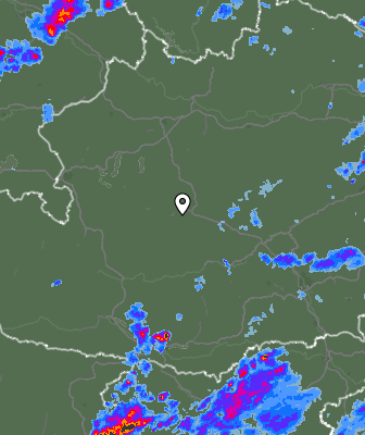 Radar