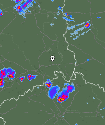 Radar