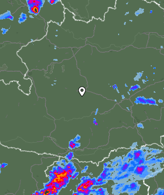 Radar