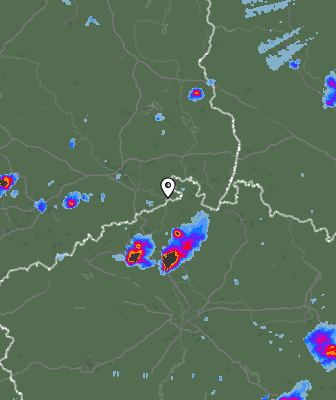 Radar