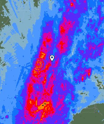 Radar