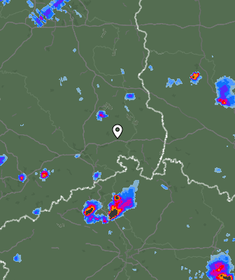 Radar