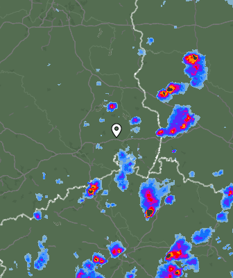 Radar