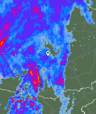 Radar