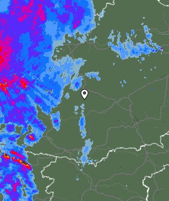 Radar