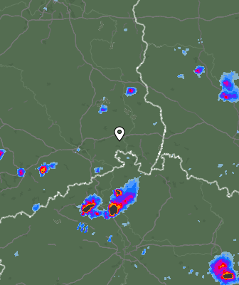 Radar