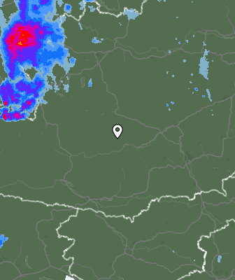 Radar