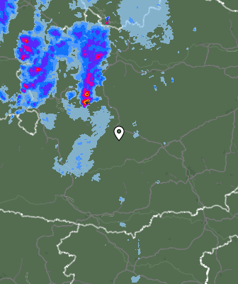Radar