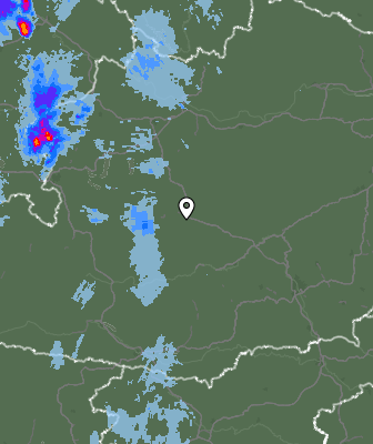 Radar
