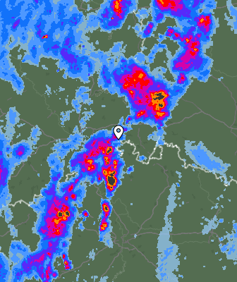 Radar