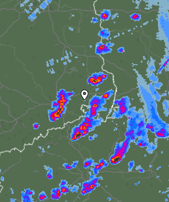 Radar