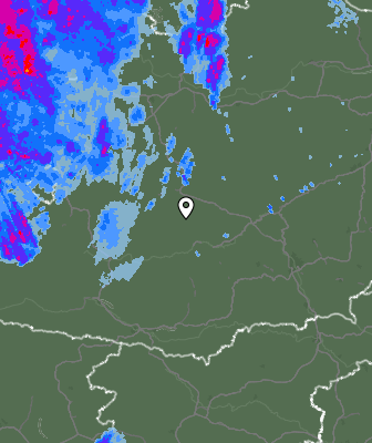 Radar
