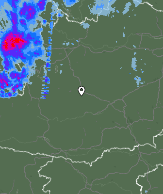 Radar