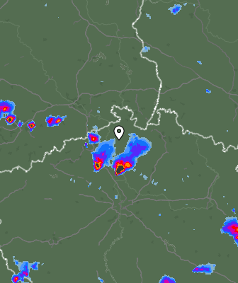 Radar