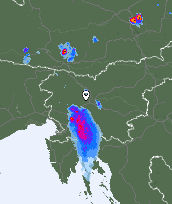 Radar
