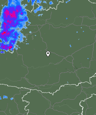 Radar