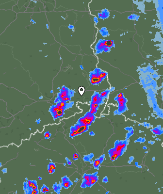 Radar