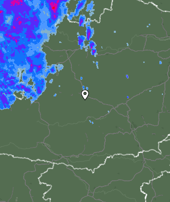 Radar