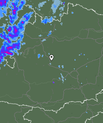 Radar