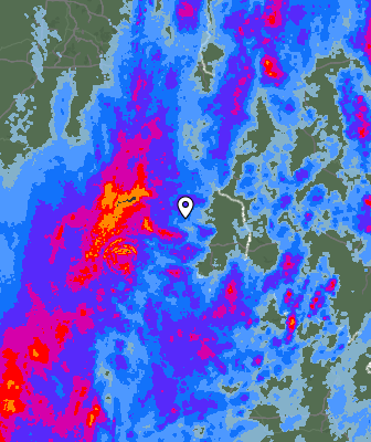 Radar