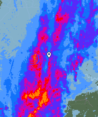 Radar