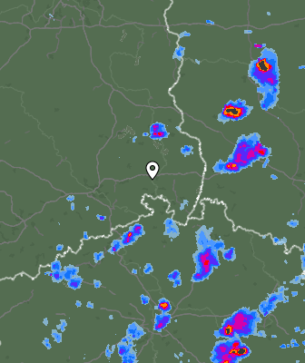 Radar