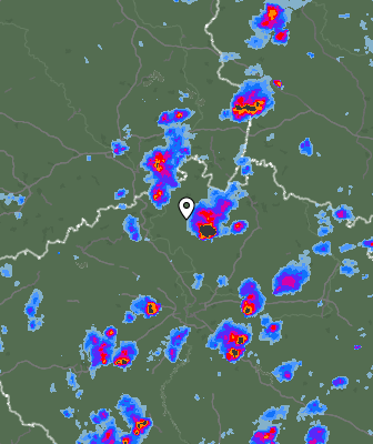 Radar