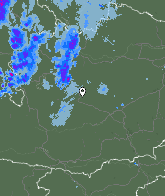 Radar