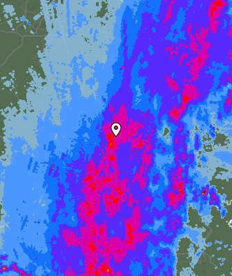Radar
