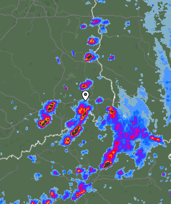 Radar