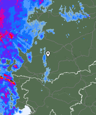 Radar