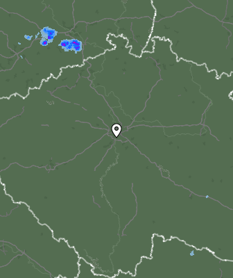 Radar