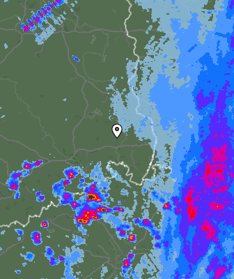 Radar