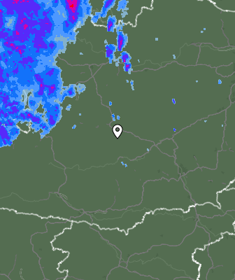 Radar