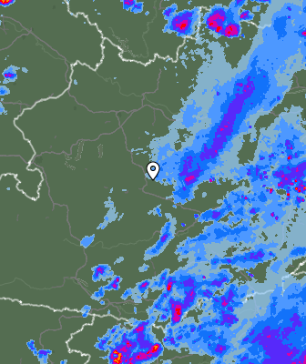 Radar