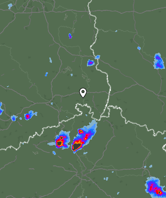 Radar