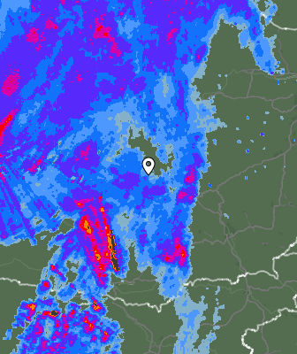 Radar