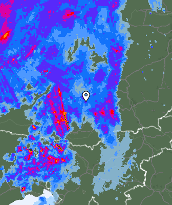 Radar