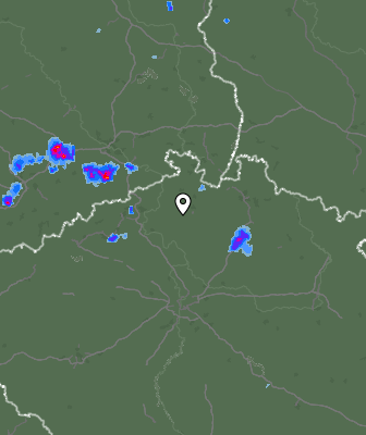 Radar