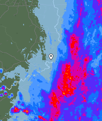 Radar