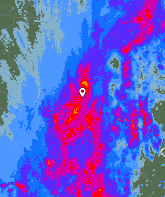 Radar