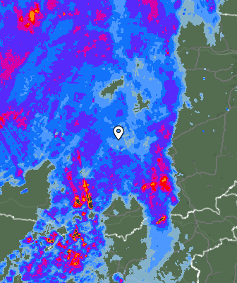 Radar