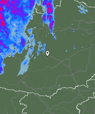 Radar