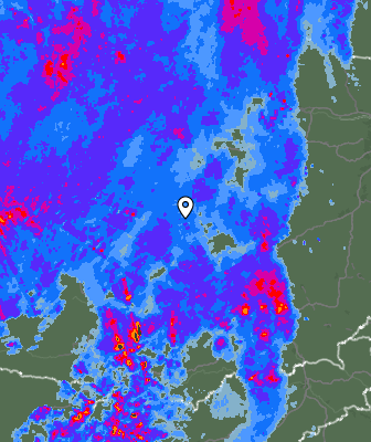 Radar